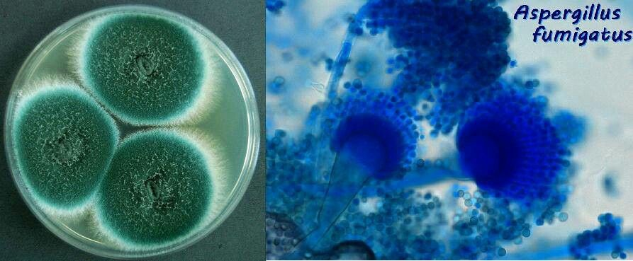 ASPERGILLUS FUMIGATUS