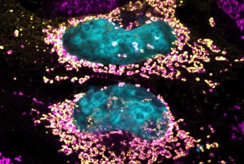 MITOCHONDRIAL COXIELLA EFFECTOR F 