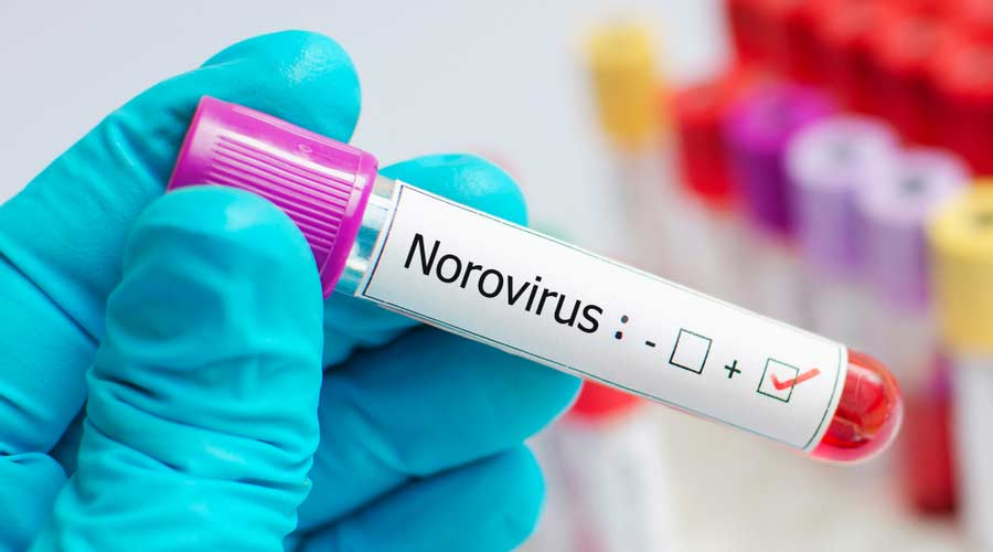 NOROVIRUS