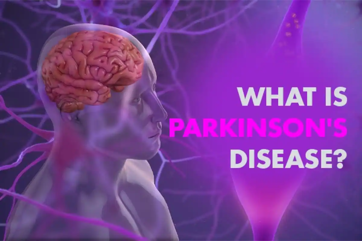 PARKINSON’S DISEASE