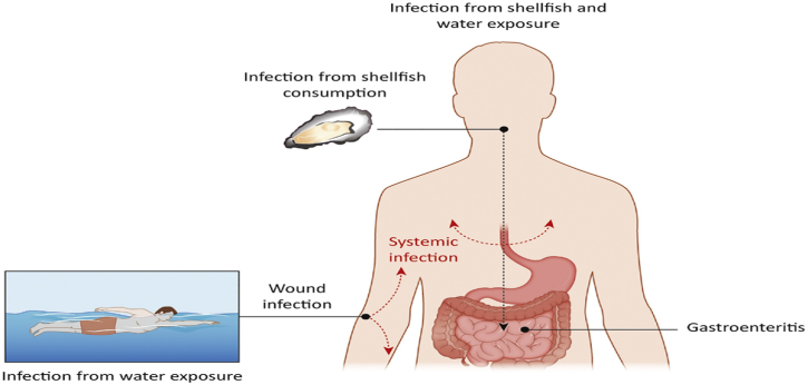 Vibrio vulnificus, a potential threat to coastal populations UPSC